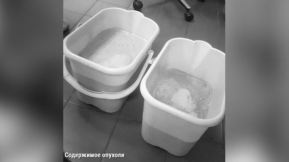 Şişin içindən çıxan 30 litr maye